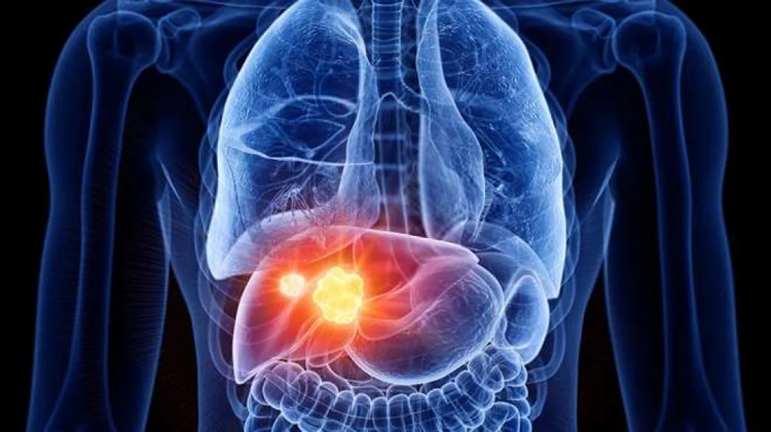 লিভারের সমস্যা হলে বুঝবেন যেভাবে